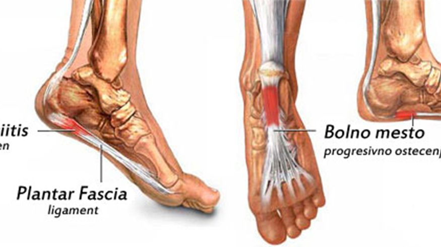 bol u zglobu na dnu noge deformirajuća artroza svih liječenja zglobova