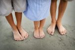 Najčešći urođeni deformitet stopala